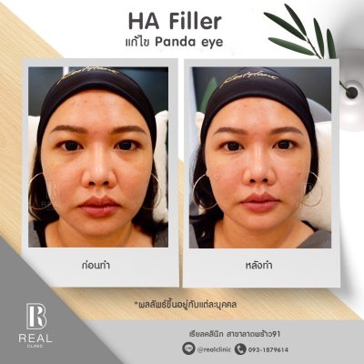 รีวิวคนไข้หมอเบนซ์