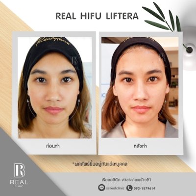 รีวิวคนไข้หมอเบนซ์