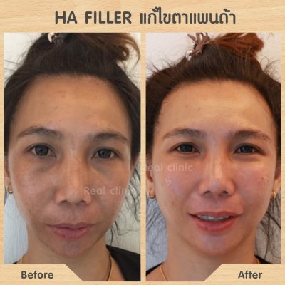 รีวิวคนไข้หมอเบนซ์