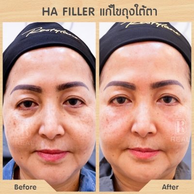 รีวิวคนไข้หมอเบนซ์