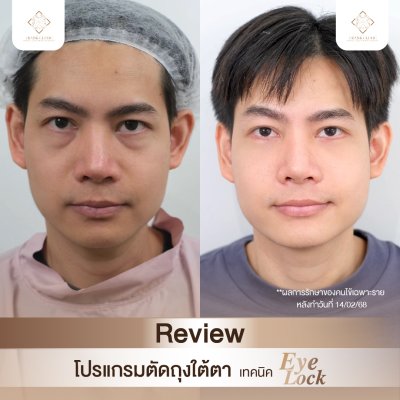 Salepage - รีวิว
