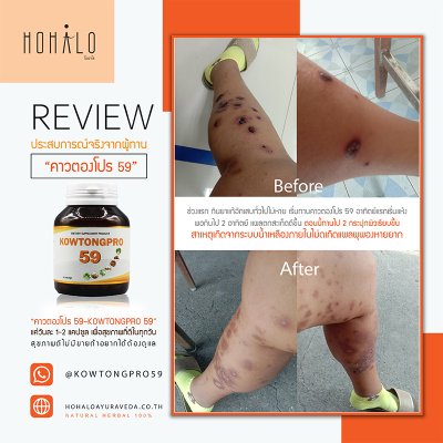 Reviews ผู้ทานผลิตภัณฑ์เสริมอาหารคาวตองโปร 59 จากประสบการณ์จริง