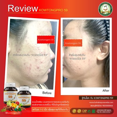 Reviews ผู้ทานผลิตภัณฑ์เสริมอาหารคาวตองโปร 59
