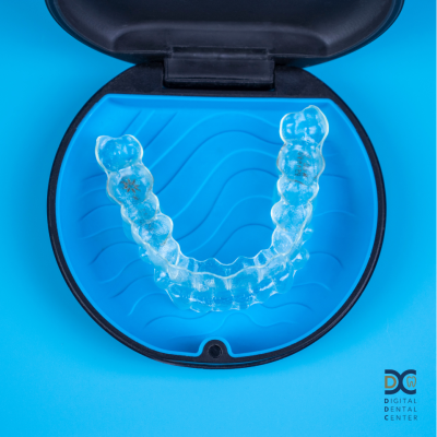 The aligners