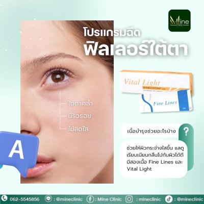 โปรแกรม ฉีดฟิลเลอร์ใต้ตา