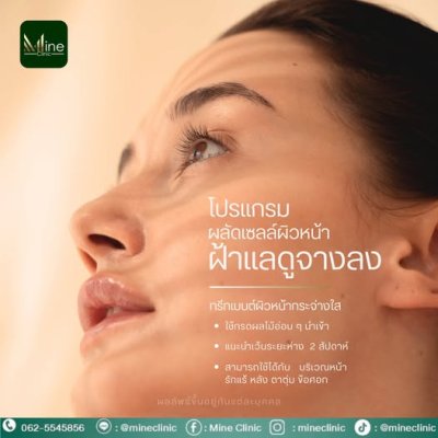 โปรแกรม ผลัดเซลล์ผิวหน้า ฝ้าแลดูจางลง