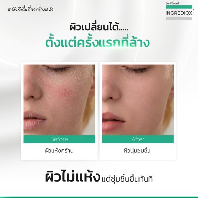 เซ็ท 3 ชิ้น MILICLAIRE ครีมล้างหน้าเนื้อน้ำนม สำหรับผิวแห้งมาก-ระคายเคืองง่าย ล้างหน้าไม่แห้งตึง ช่วยฟื้นสมดุล MicroBiome