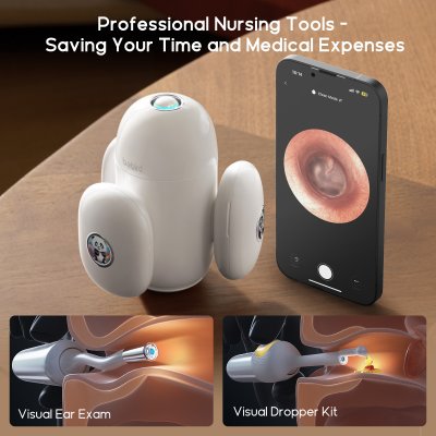 Bebird Smart Visual Ear Cleaner 30S