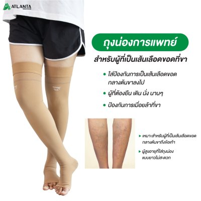ถุงน่องเส้นเลือดขอด ถุงน่องเส้นเลือดขอด