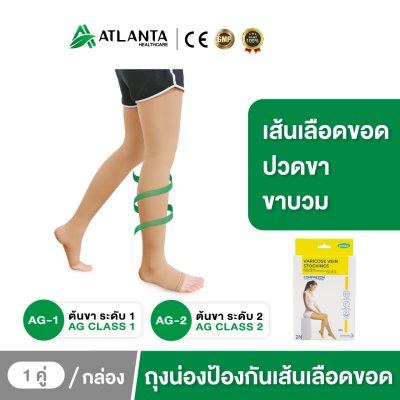 ถุงน่องเส้นเลือดขอด