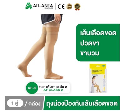 ถุงน่องเส้นเลือดขอด