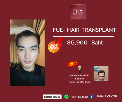 Hot Deal: FUE Hair Transplant at D-Hair Center Bangkok