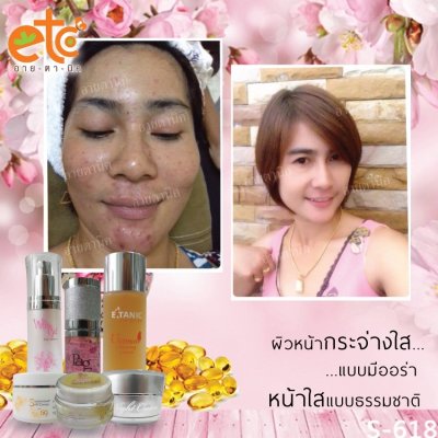 Before After