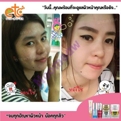 Before After