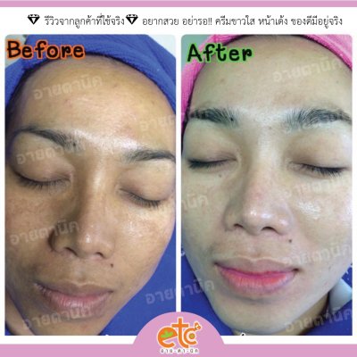 Before After