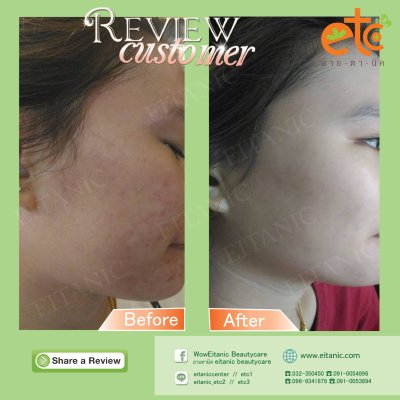 Before After