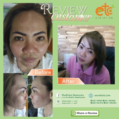Before After
