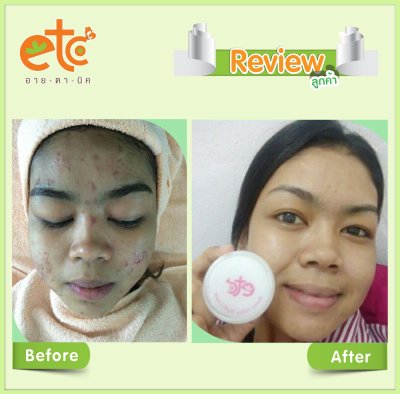 Before After