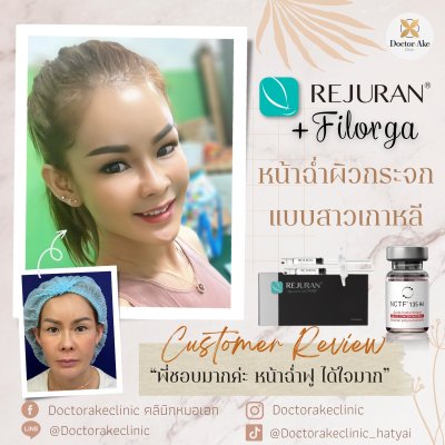 Rejuran+Filorga