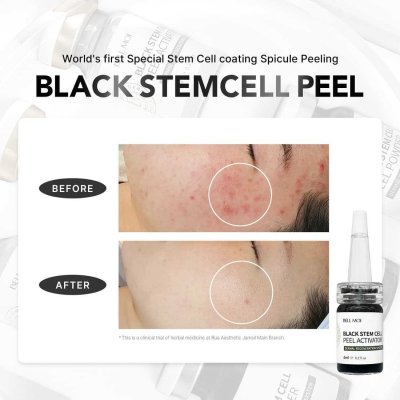 BELL MOI BLACK STEM CELL PEEL