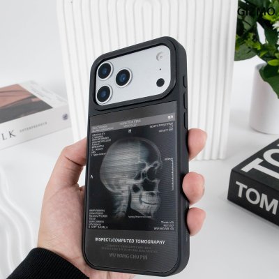 GIZMO WWPC Metal Black Case with MagSafe Computed Tomography เคสมือถือลายสแกนกะโหลก Metal iPhone 17