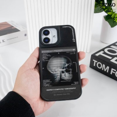 GIZMO WWPC Metal Black Case with MagSafe Computed Tomography เคสมือถือลายสแกนกะโหลก Metal iPhone 17