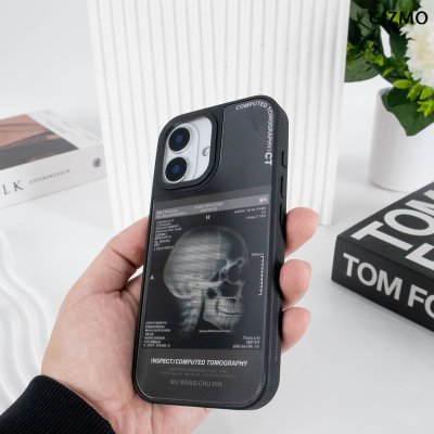 GIZMO WWPC Metal Black Case with MagSafe Computed Tomography เคสมือถือลายสแกนกะโหลก Metal iPhone 17