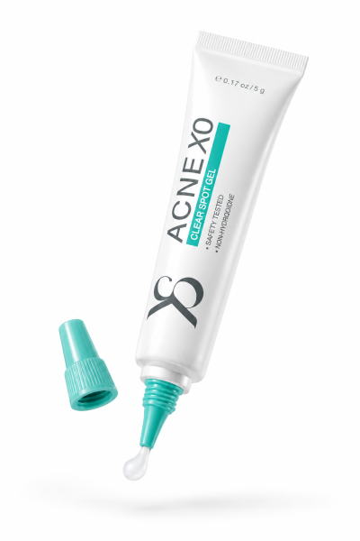 Acne X0