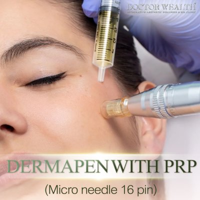 DERMAPEN WITH PRP (Micro needle 16pin)