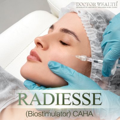 RADIESSE(Biostimulator)CAHA