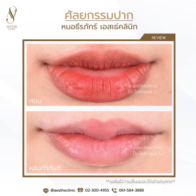 ศัลยกรรมปาก