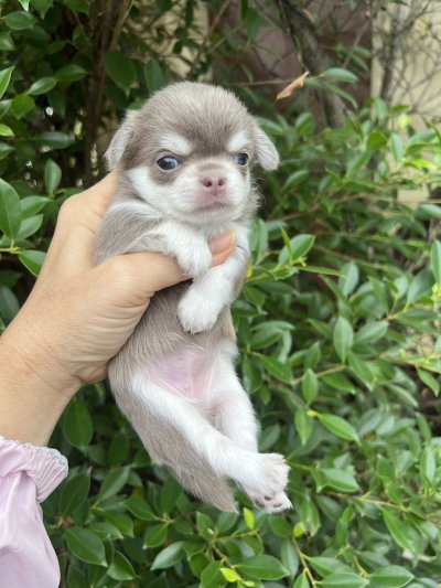 ผู้หญิงขนยาว น้องเอมี่ (Amy)