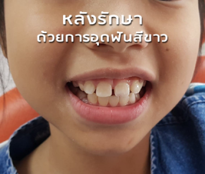 ผลงานการรักษา