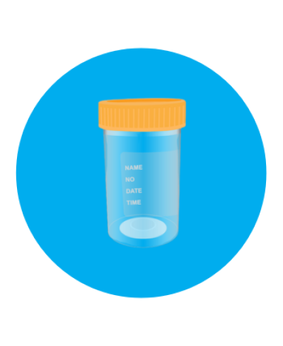 Urine Cup 60ml non Sterile (ทรงตรง)