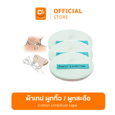 เชือกผูกทิ้ว เชือกผูกสะดือ