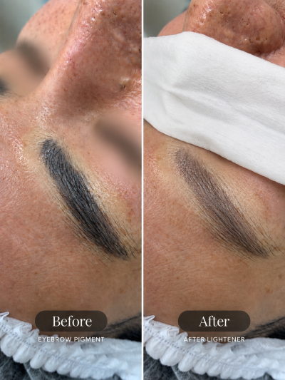 รีวิวแก้คิ้วด้วย Lightener ก่อนทำและหลังทำครั้งแรก ภาพเปรียบเทียบมุมที่ 2