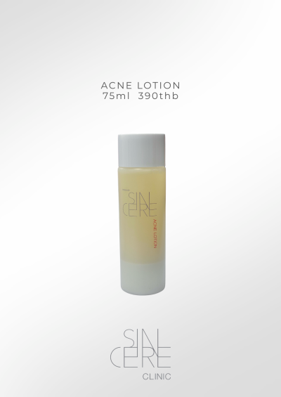 Acne Lotion