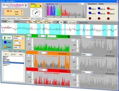 Brainfeedback BFB Brainfeedback BFB