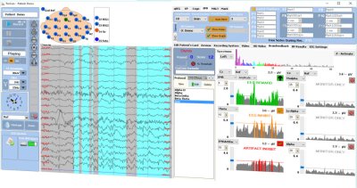 TruScan LT Neurofeedback System TruScan LT Neurofeedback System