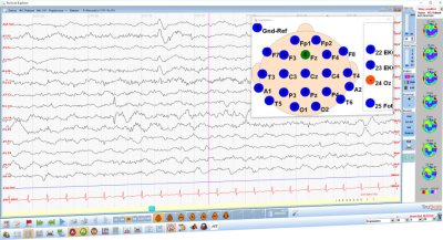 TruScan LT Neurofeedback System TruScan LT Neurofeedback System