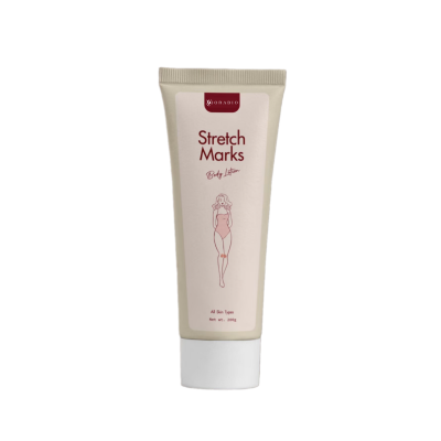 Stretch Marks Body Lotion Stretch Marks Body Lotion
