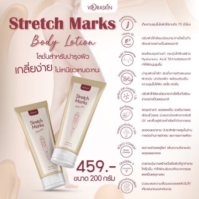 Stretch Marks Body Lotion Stretch Marks Body Lotion