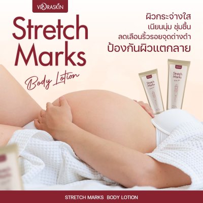 VIORABIO (วิโอร่าไบโอ)Stretch Marks  Body Lotion