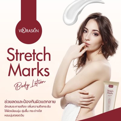 VIORABIO (วิโอร่าไบโอ)Stretch Marks  Body Lotion