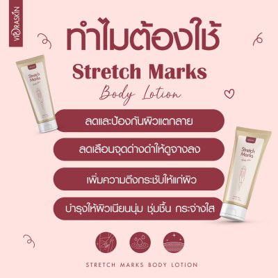 Stretch Marks Body Lotion Stretch Marks Body Lotion