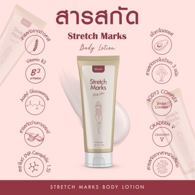 Stretch Marks Body Lotion Stretch Marks Body Lotion