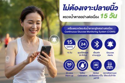 CareSens Air ระบบตรวจวัดระดับน้ำตาลในเลือดอย่างต่อเนื่อง (CGMS)