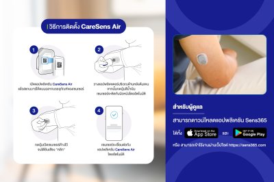 CareSens Air ระบบตรวจวัดระดับน้ำตาลในเลือดอย่างต่อเนื่อง (CGMS)