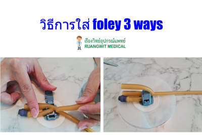 Ugo Fix Gentle แผ่นยึดติดสายสวนปัสสาวะ (1 ซอง)