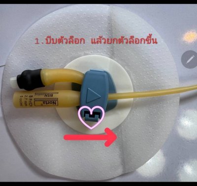 Ugo Fix Gentle แผ่นยึดติดสายสวนปัสสาวะ (1 ซอง)